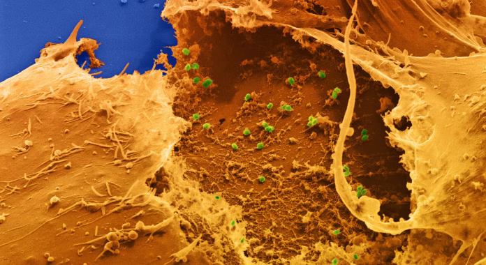 wo5kqkcmdrfxte3bxfrriuqu54avif