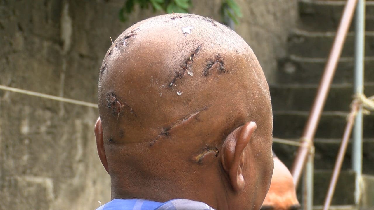 COMERCIANTE DA BEIRA É PELA QUARTA VEZ VÍTIMA DE ASSALTO, TORTURA E INVASÃO ARMADA