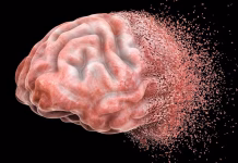 Estudo revela em tempo real como o Alzheimer danifica o cérebro